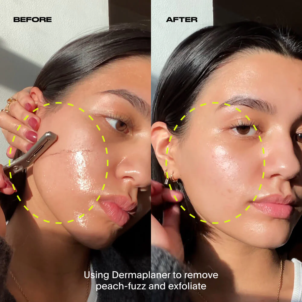 Dermaplaner Kit, Fig - Image 8